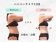 美容整体 ウェリナ 蟹江院/小顔矯正/骨盤矯正/痩身整体