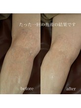 サロン ド ブリーズ(salon de breathe)/施術前後のお写真
