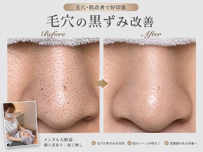 ナンバー511(No.511)の写真