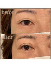 ファビー(Fabby)/★まつ毛パーマ★