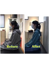 くすの樹接骨院 整体院 吉野ヶ里院/整体/骨盤矯正ビフォーアフター