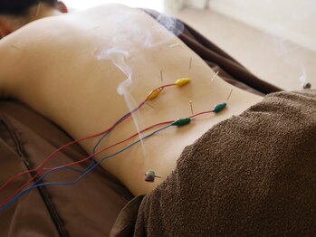 ハリュウ 新越谷/鍼灸