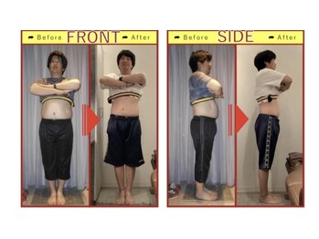 栄光治院 刈谷院/【腸内改善before→after】