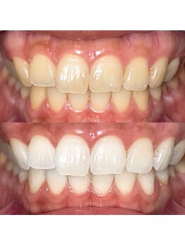 ライトビューティー 池袋店(LightBeauty)/症例写真