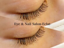 エムエスエー エクラ(MSA Eclat)/まつ毛エクステ100本