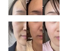 エム 佐賀江北店(EMU)/リフトアップ！