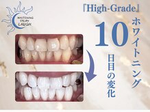 ラフ(LAUGH)/【審・美・白】 ホワイトニング