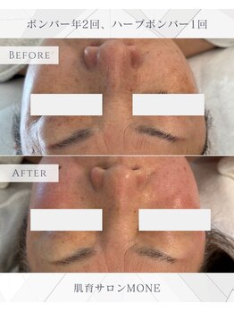 モネ オキナワ(MONE okinawa.)/60代のお客様も