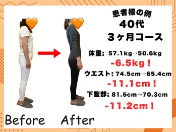整体院ニコット/40代 3ヶ月ダイエット成果