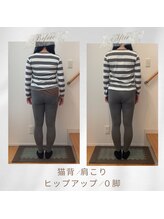 りもあず(ReMore-S)/矯正×ホームケア/反り腰/猫背