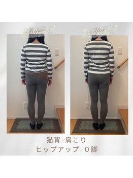 りもあず(ReMore-S)/矯正×ホームケア/反り腰/猫背