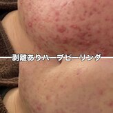 エヌハーブ(NHerb)