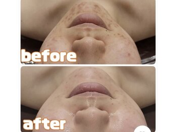 エステティック レイビス 川崎店(RAYVIS)/