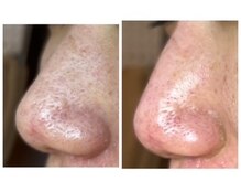 ミント/触るとぬめりを感じる鼻さん