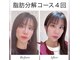 リジュベネ(rejuvena)の写真/【渡韓せずに最新美容！脂肪分解で二重あごとさよなら♪理想の輪郭へ】男女問わず施術可◎40代男性急増中！
