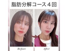 リジュベネ(rejuvena)