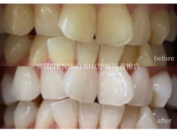 ホワイトニングショップ 福岡香椎店/美容ホワイトニングサロン