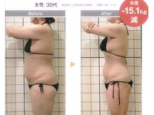 エリザ(ELIZA)の雰囲気（BACK4 施術 Before After !）