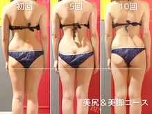 ルシール 仙台店(lucir)/【ヒップアップ】Before/After