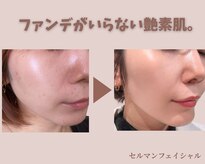 フェイスプラスリフ(FACE+RiF)