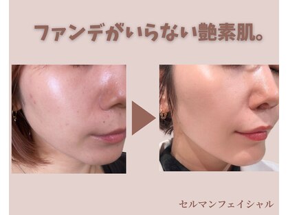 フェイスプラスリフ(FACE+RiF)の写真