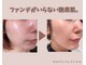 フェイスプラスリフ(FACE+RiF)の写真