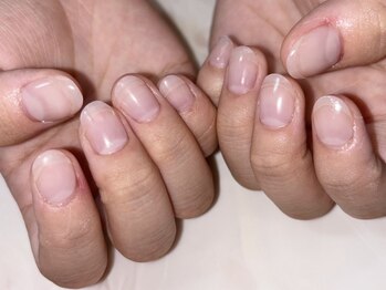 いろこびん 盛岡フェザン店(irokobin)/深爪矯正