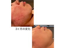 アミュレット(AMULET)の雰囲気（【皮膚理論に基づいたスキンケア】お肌のマイナス要因デトックス）