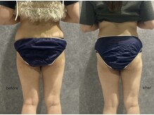 リボーン(REBORN)/産後ケアーダイエット