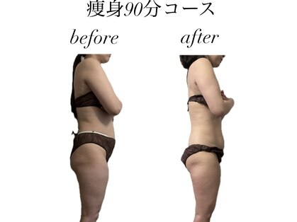 リベラ(RIVELA)の写真