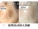パールホワイトニングサロン 小田原店の写真