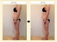 カロン(Kalon)/痩身