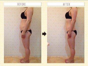 カロン(Kalon)/痩身