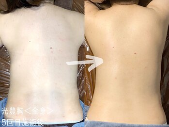 ルーナジェーナ(Luna llena)/バストケアで全身スタイルアップ