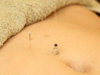 段上はり灸整骨院/温かく、優しいお灸が特徴です♪