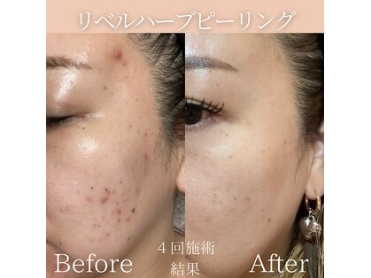 リフィール(Re:feel)の写真