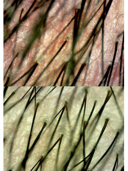四季/高濃度炭酸が血行促進◎