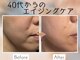ル シェノン(Le Chainon)の写真