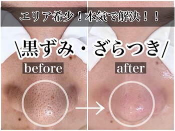 ニュートラル(neutral)