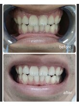 エクシアホワイト 北24条駅前店/