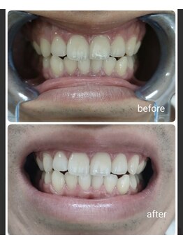 エクシアホワイト 北24条駅前店/