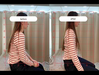 サンゴ(Sango)/猫背/肩こり/小顔/姿勢改善