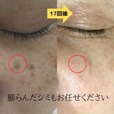 パルサロン(palsalon.)