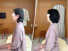 リリーフポート フェミナ鍼灸整体院 大濠公園店/お悩み：寝つきの悪さ