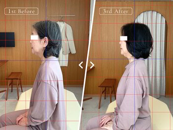 リリーフポート フェミナ鍼灸整体院 大濠公園店/お悩み：寝つきの悪さ