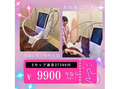 スポットスリム(SPOT SLIM)の写真