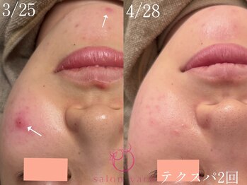 サロンヴェアリー 広尾(salon vary)/恵比寿広尾｜水玉テクスパ
