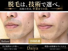ダイヤ 名古屋中川区店(Daiya)