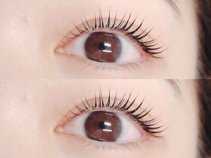 ブリンク(BLINK)の写真