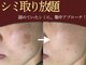 ナナラの写真
